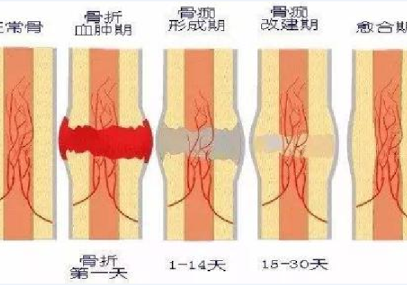 错误