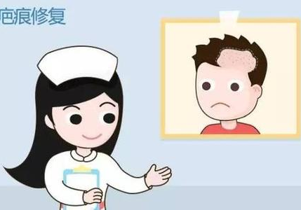 错误