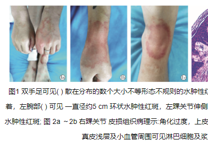 错误