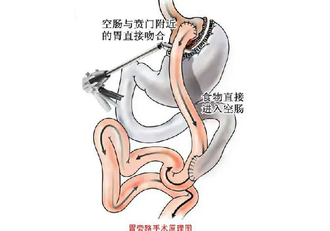 错误