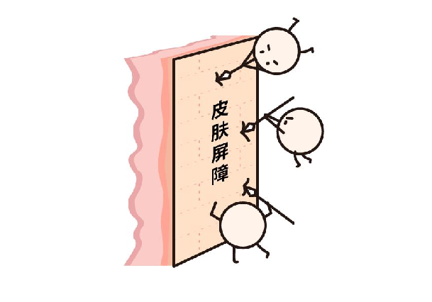 错误