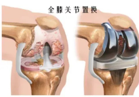 错误