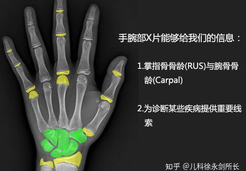 错误