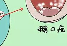 错误