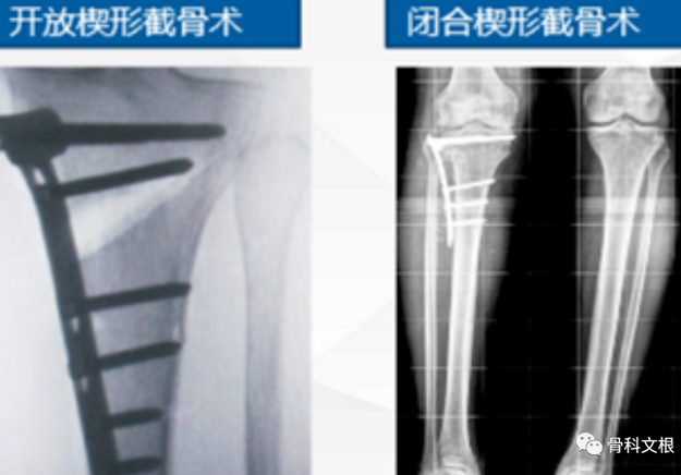 错误