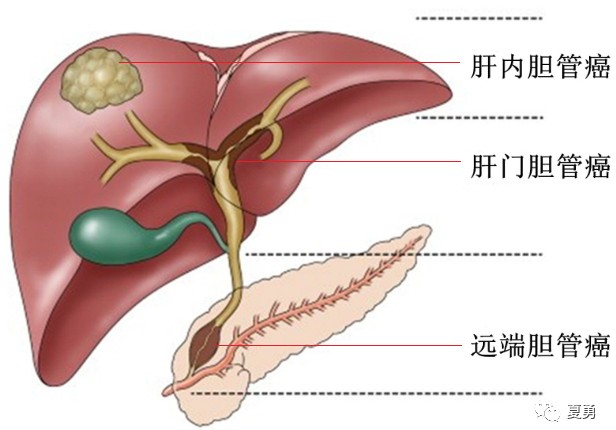 错误
