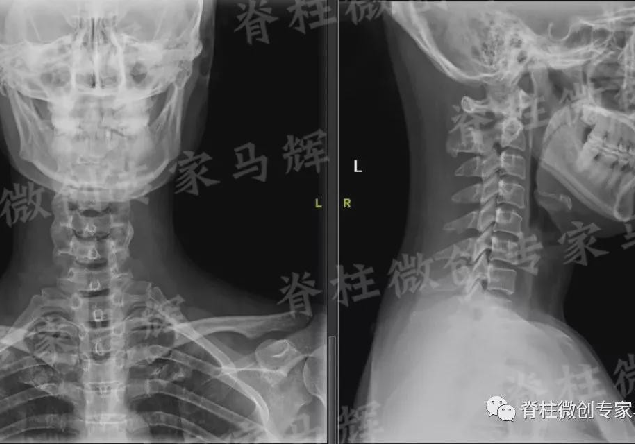 错误