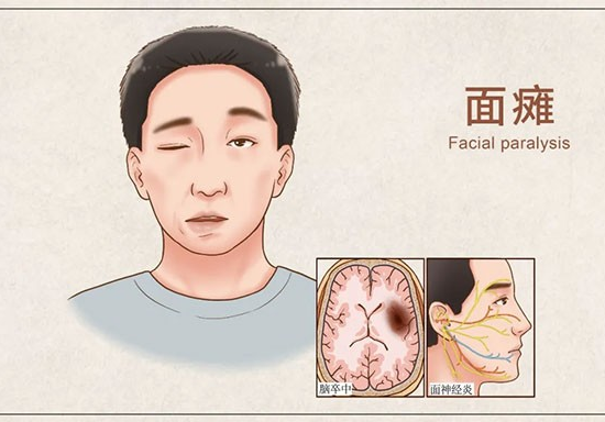 错误