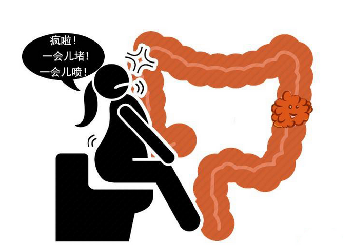 错误