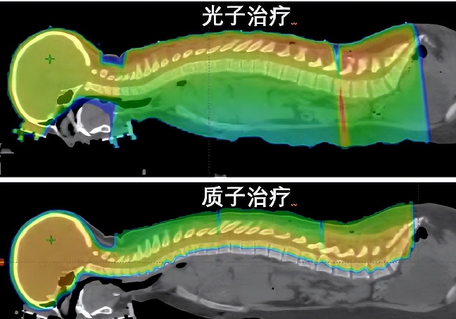 错误