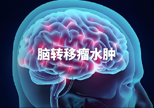 错误