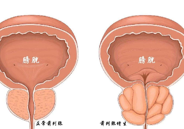 错误