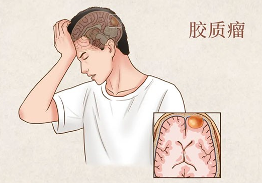 错误